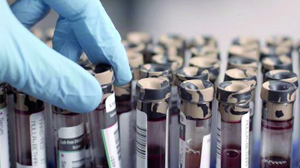 Der Bluttest - Welches Kind soll leben?